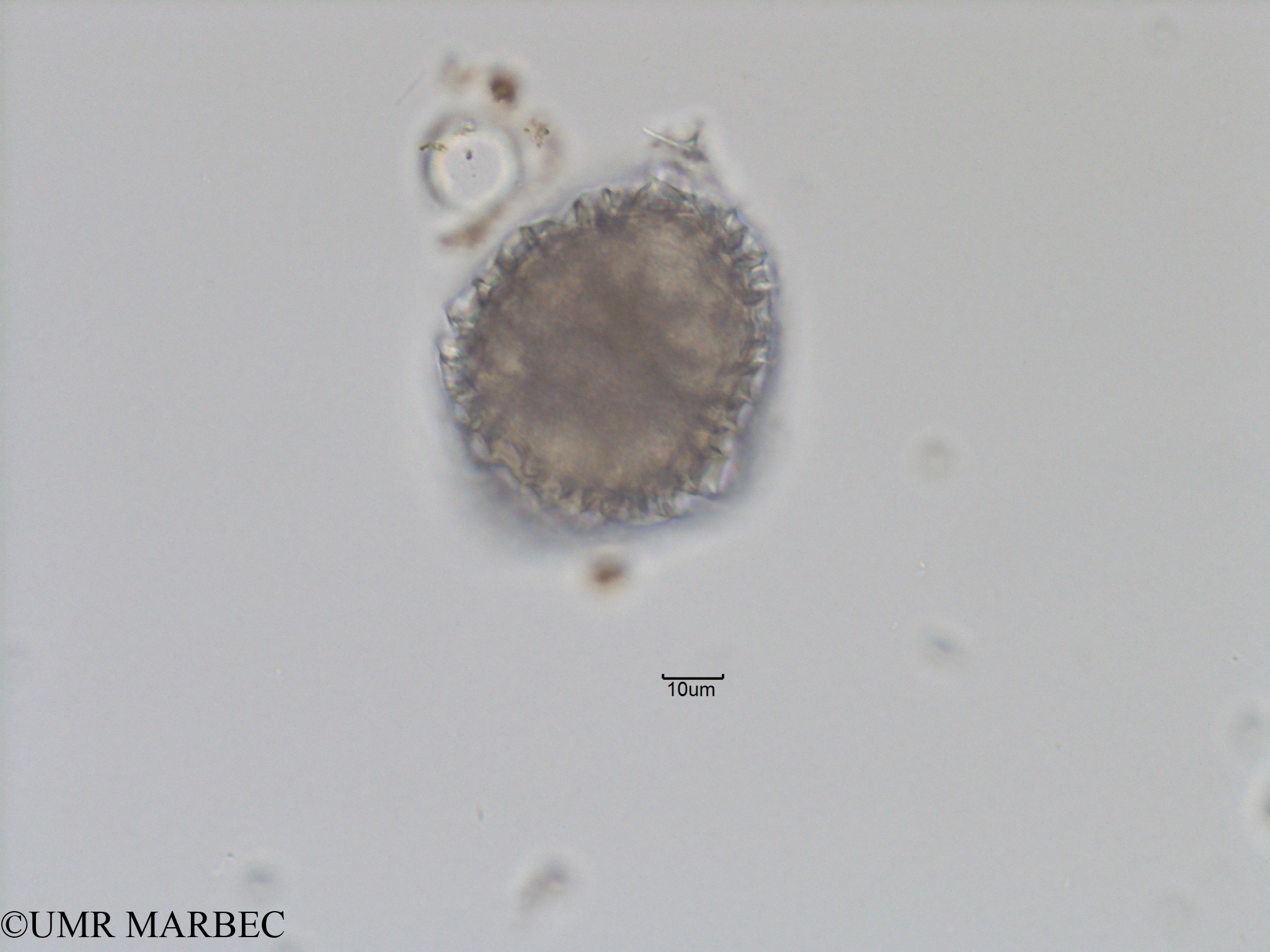 phyto/Bizerte/bizerte_bay/RISCO November 2015/Protoceratium sp4 (Baie_T5-C2-Protoceratium sp2-6).tif(copy).jpg